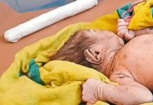 ବୁଦା ମୂଳରୁ ପରିତ୍ୟକ୍ତ ଅବସ୍ଥାରେ ନବଜାତ ଶିଶୁ କନ୍ୟା ଉଦ୍ଧାର